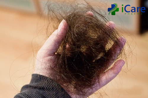 9 cách trị tóc thưa mỏng cho nam nữ Nguyên nhân và chăm sóc