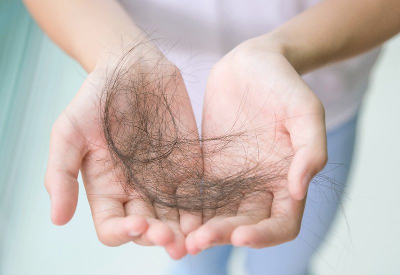 Tại sao tóc rụng không mọc lại và những biện pháp khôi phục sức