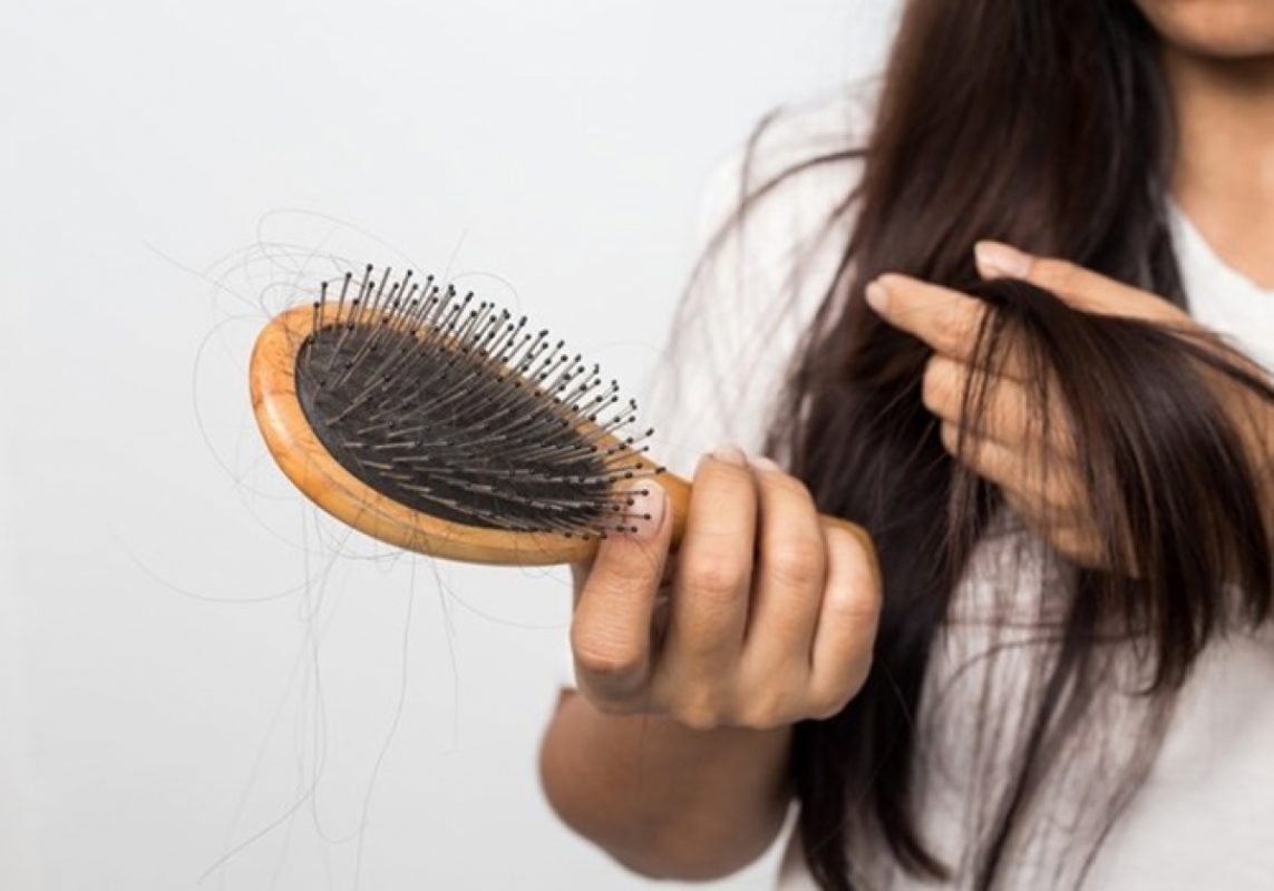 10 cách chống rụng tóc tại nhà hiệu quả Dễ không tưởng  iCare Pharma