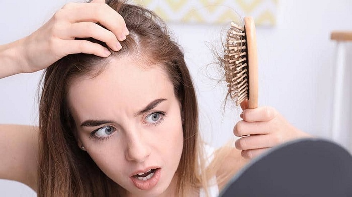 Rụng tóc nhiều ở nam tuổi dậy thì  Trẻ có thể bị hói đầu sớm
