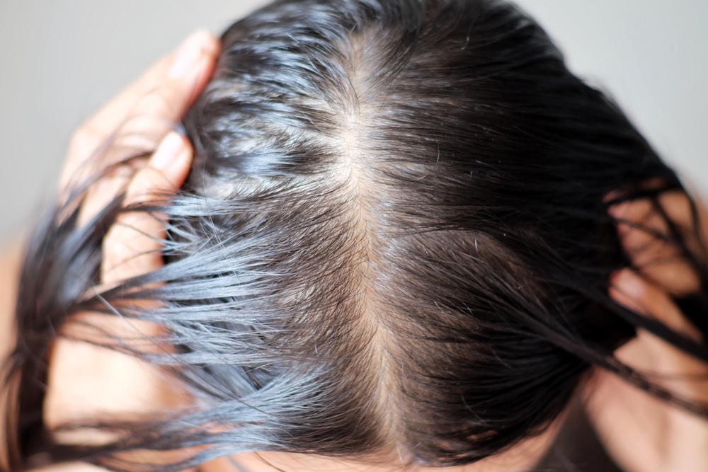 Da đầu nhờn da chất hoá học trong sản phẩm chăm sóc tóc 