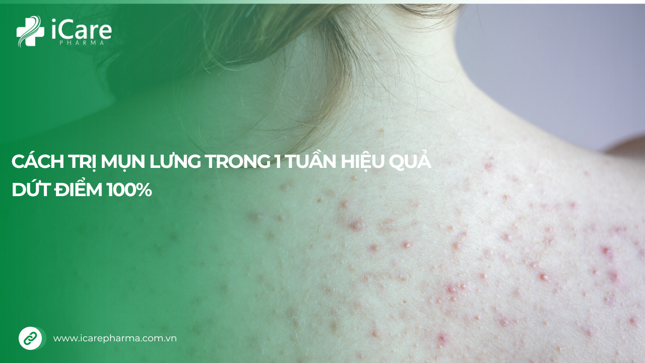 Cách trị mụn lưng trong 1 tuần