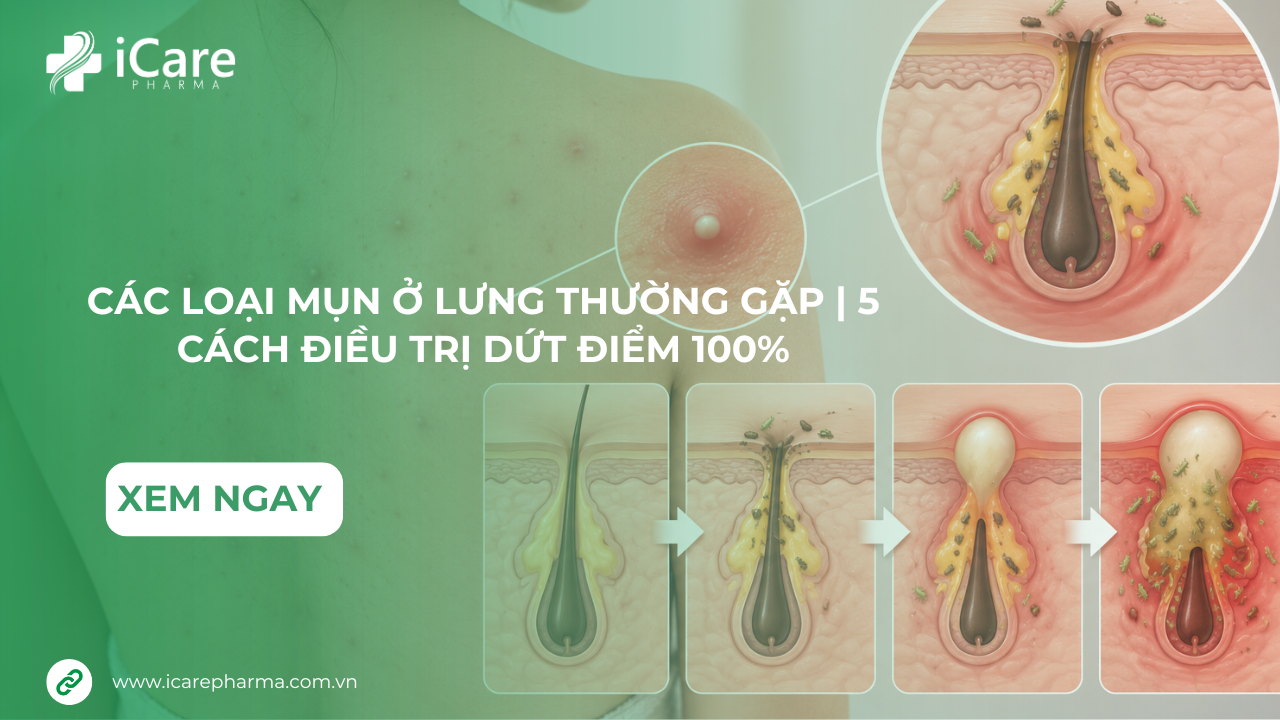 cac-loai-mun-lung-thuong-gap