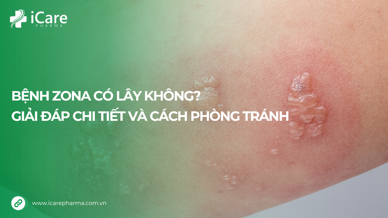 Bệnh zona có lây không