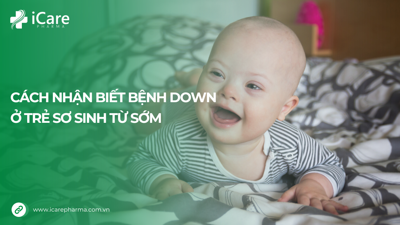 Nhận biết bệnh down ở trẻ sơ sinh