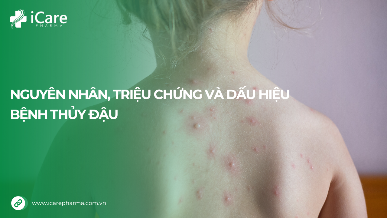 dấu hiệu bệnh thủy đậu