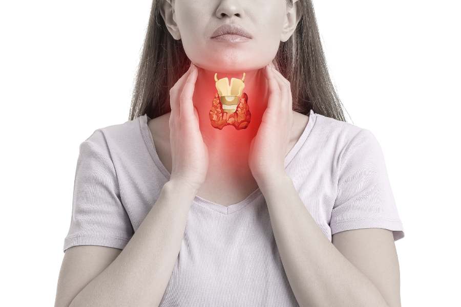 bệnh cường giáp 