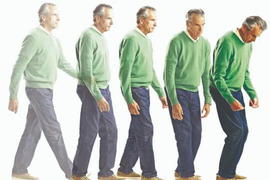 triệu chứng parkinson