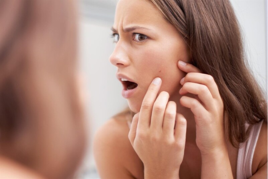 cách trị mụn ẩn