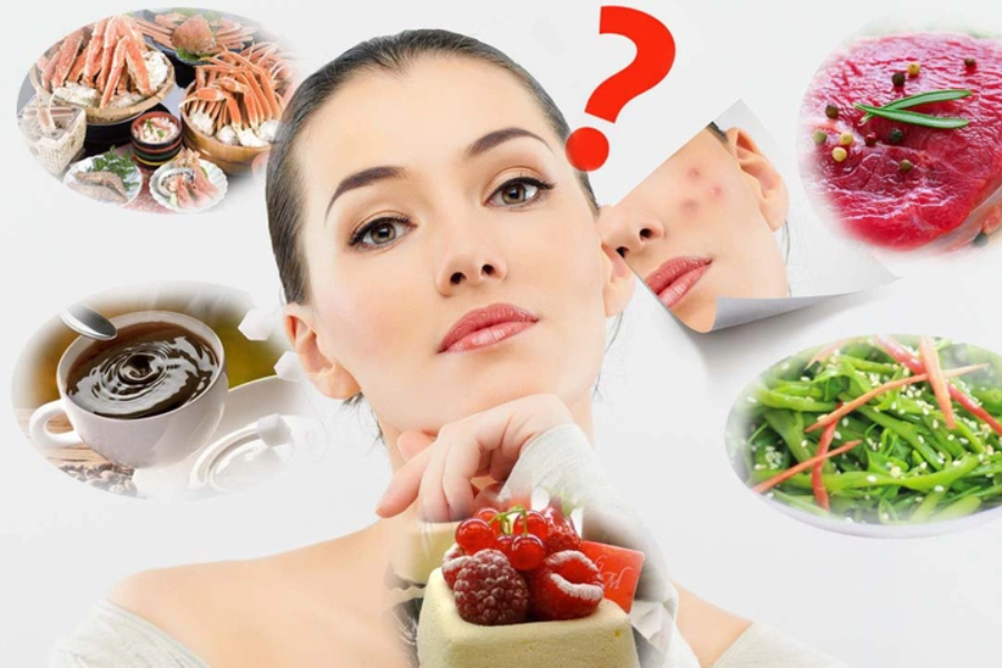 chế độ ăn uống ngừa mụn