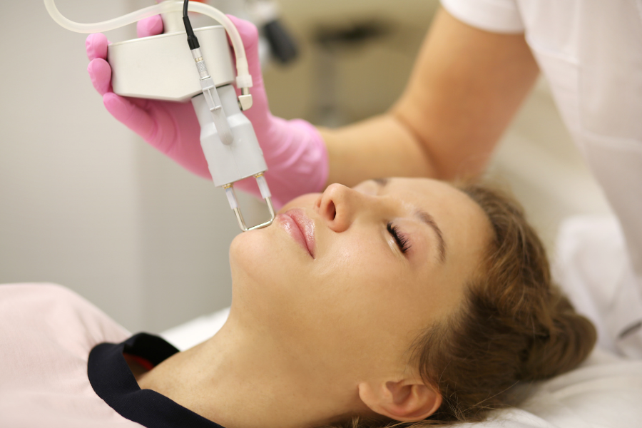 trị nám bằng laser