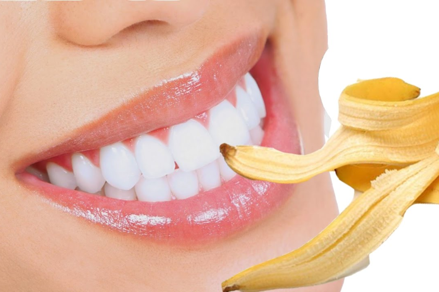 mẹo trắng răng bằng vỏ chuối 