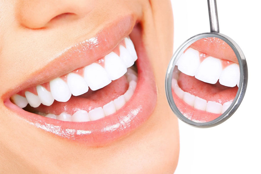 chi phí trồng răng implant 