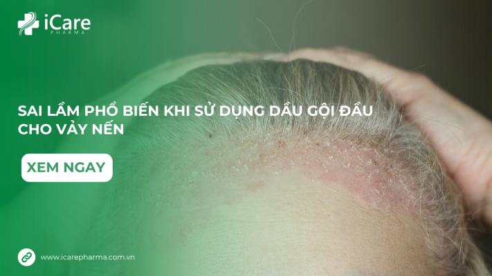 sai-lam-pho-bien-khi-su-dung-dau-goi-vay-nen