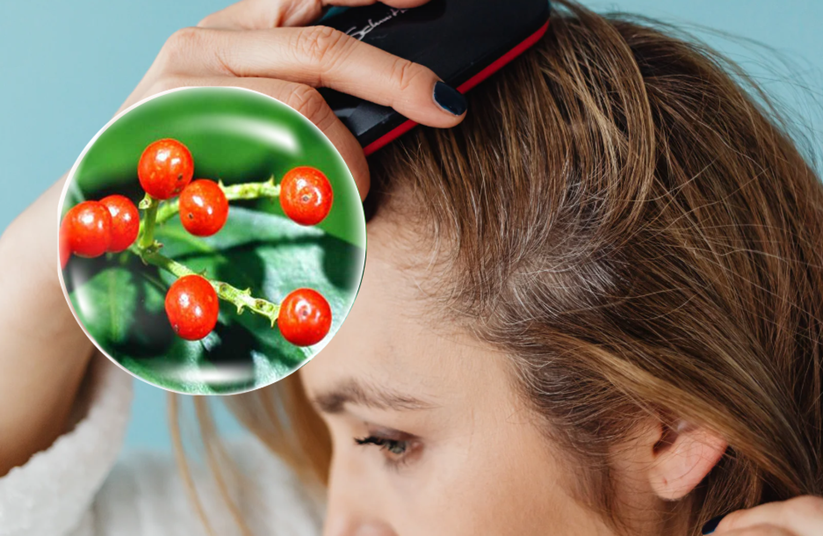 Sự thật về mối quan hệ giữa chế độ ăn uống và vảy nến trên da đầu