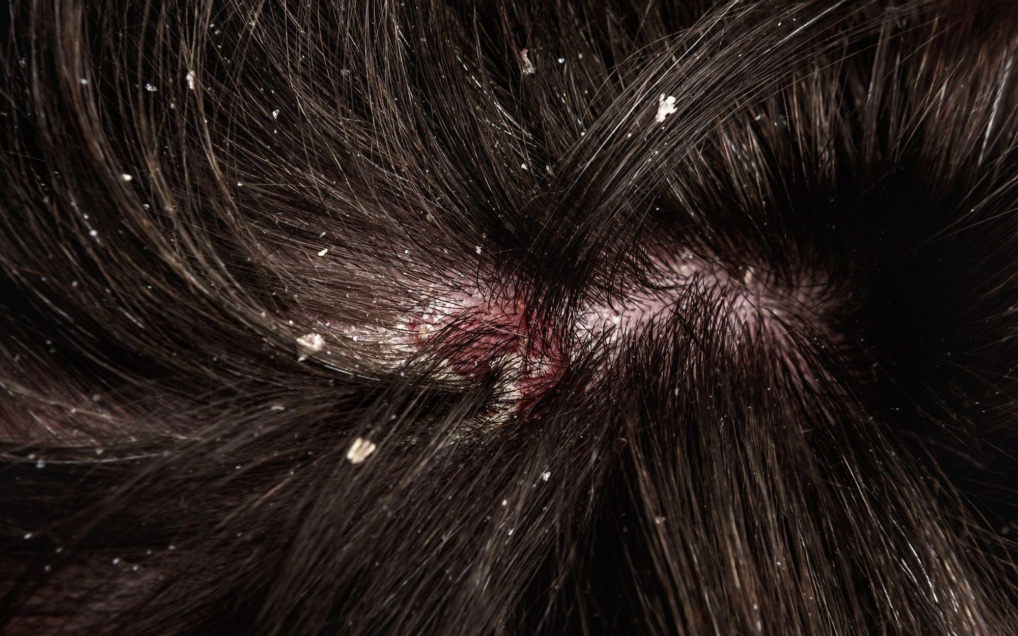 Da đầu cân bằng pH