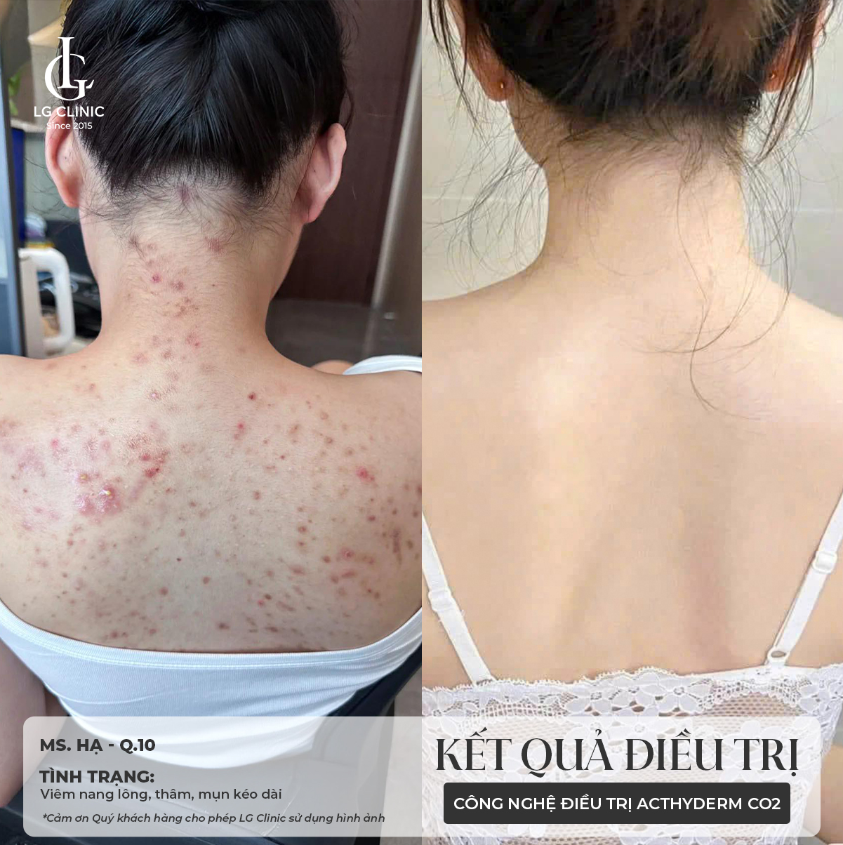 Sữa tắm <a href=