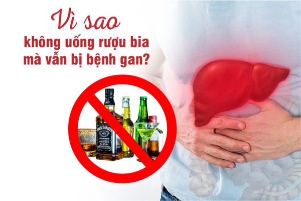 Gan nhiễm mỡ không do rượu