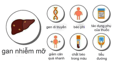 Nguyên nhân gan nhiễm mỡ