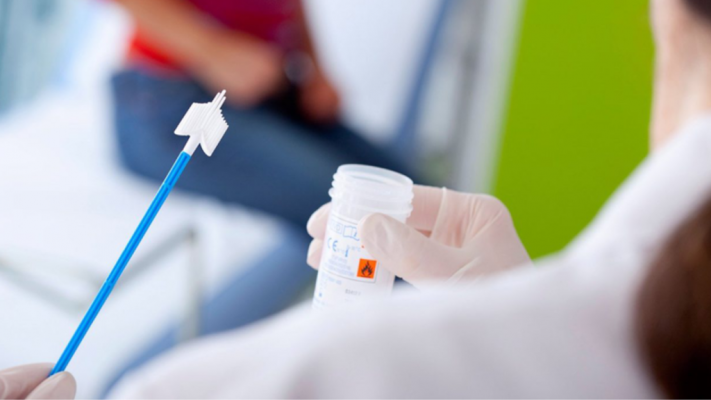 Xét nghiệm hpv 