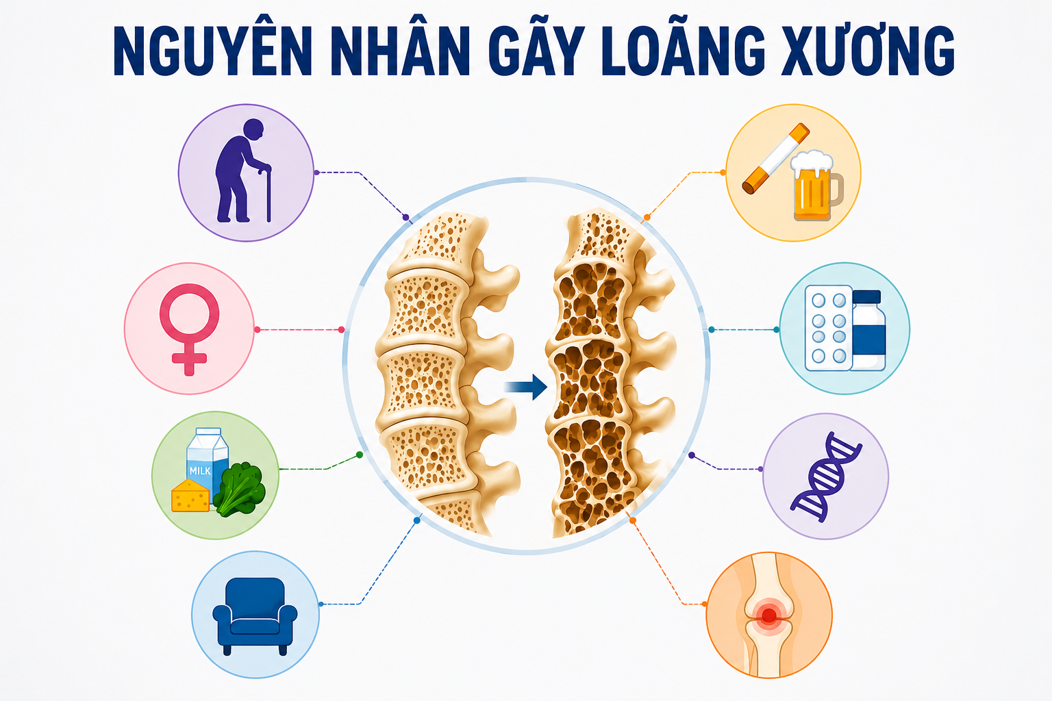 nguyen-nha-gay-loang-xuong
